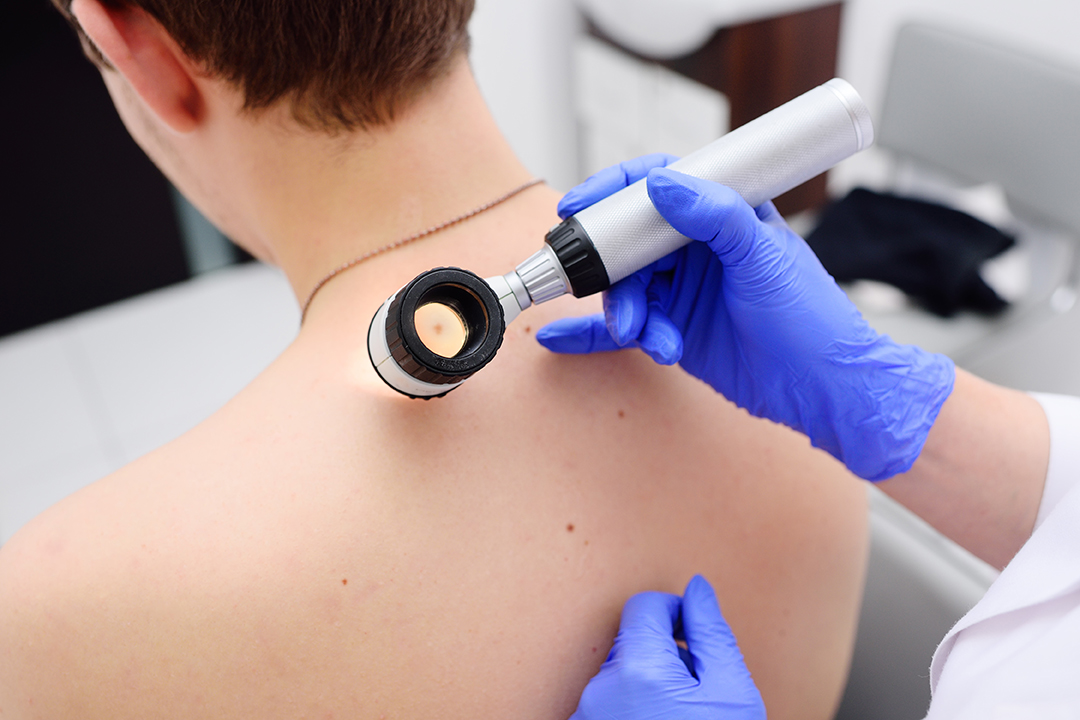 How Often Should You Get a Skin Check in Perth?