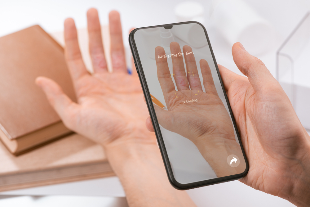 Skin cancer on Finger